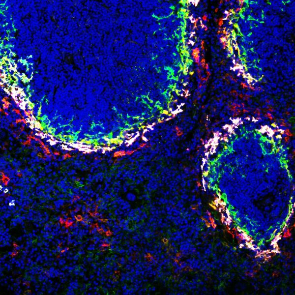 Spleen Naldini lab